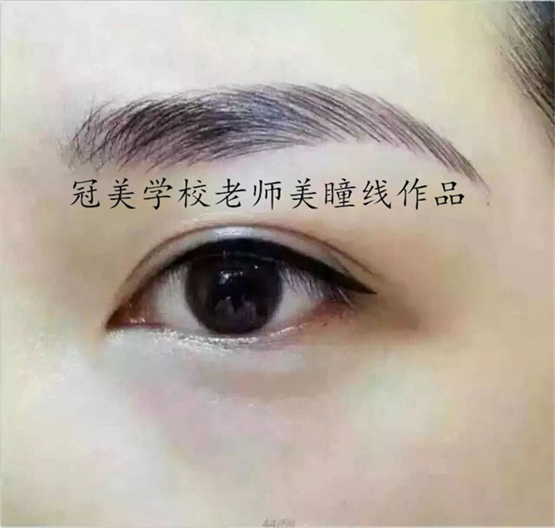 Ʒ-ͫ
