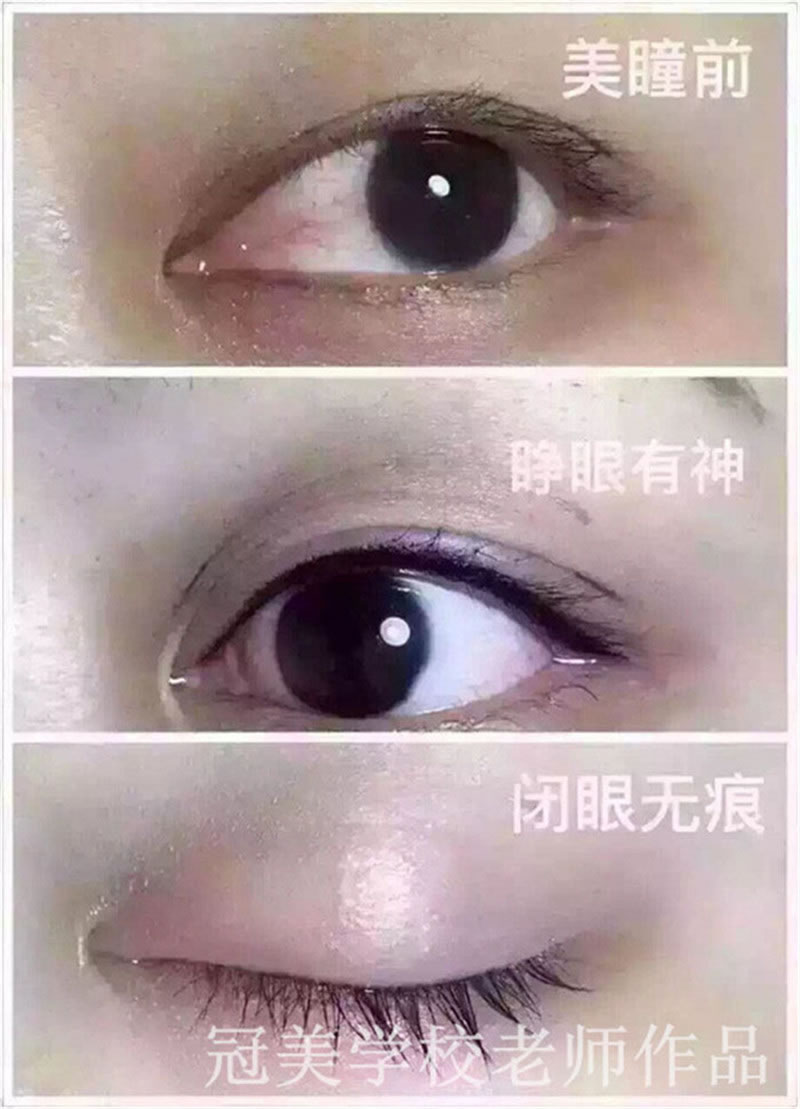 Ʒ-ͫ